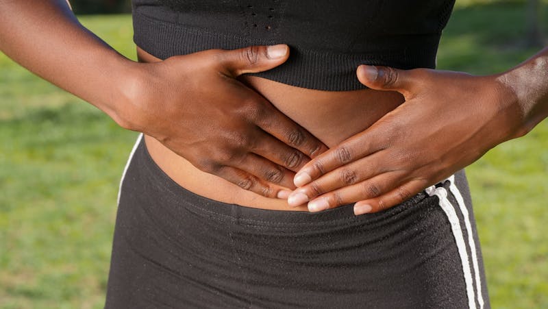 Diastasis Recti